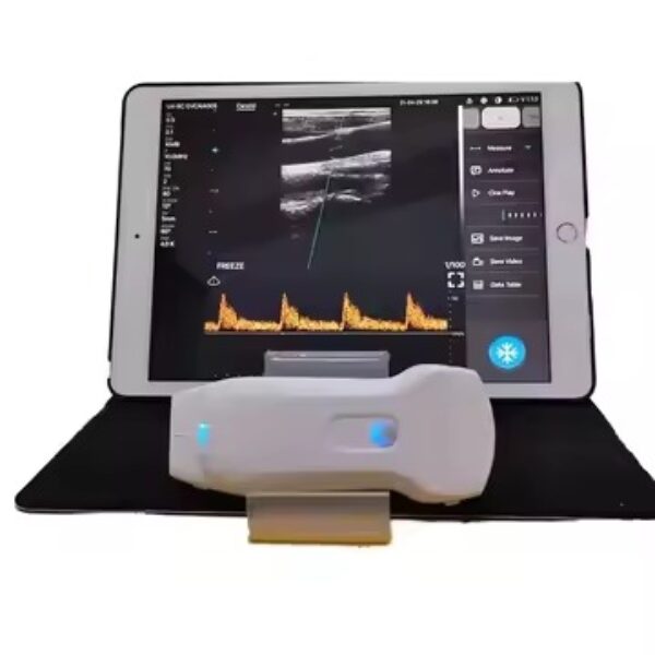 Ultrasonido inalámbrico MSLPU80