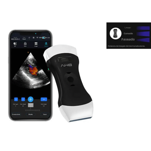 Ultrasonido inalámbrico MX3