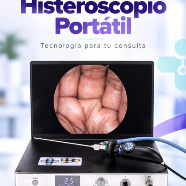 Histeroscopio
